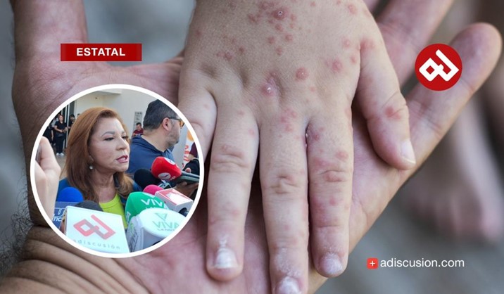Suman 11 escuelas de Culiacán con casos de coxsackievirus: SEPyC