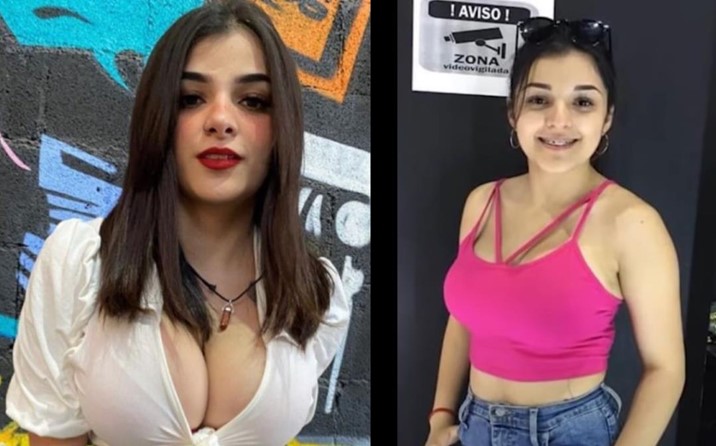  ¿Cuántas operaciones tiene Karely Ruiz? Te contamos cuáles cirugías se ha hecho